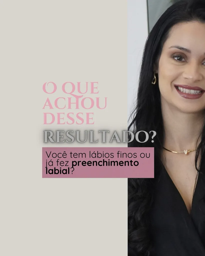 labios 5