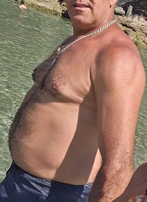 Emagrecimento - Antes