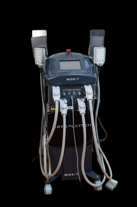 Kryoplatten