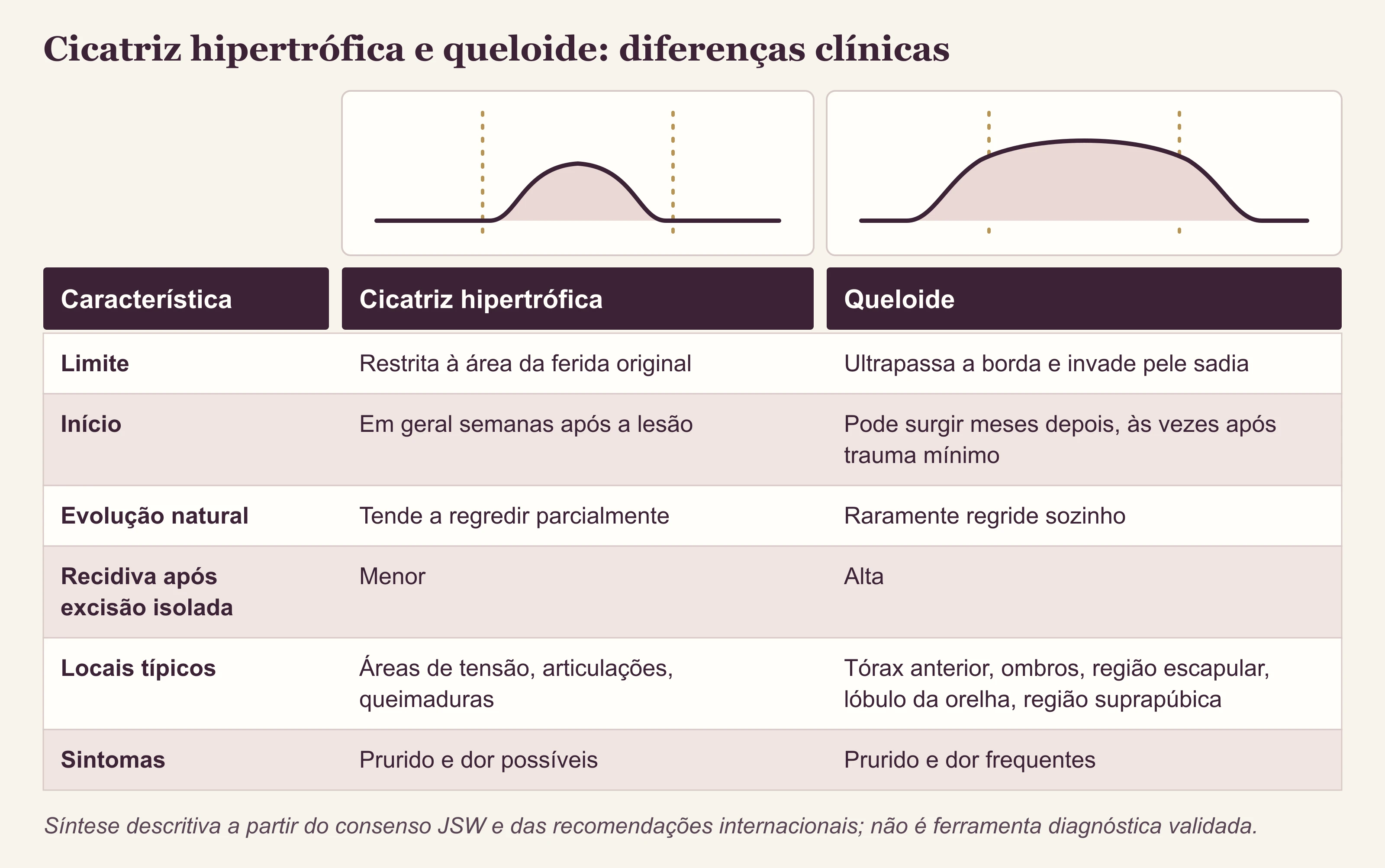 Quadro comparativo em duas colunas entre cicatriz hipertrófica e queloide, com seis linhas de características clínicas.