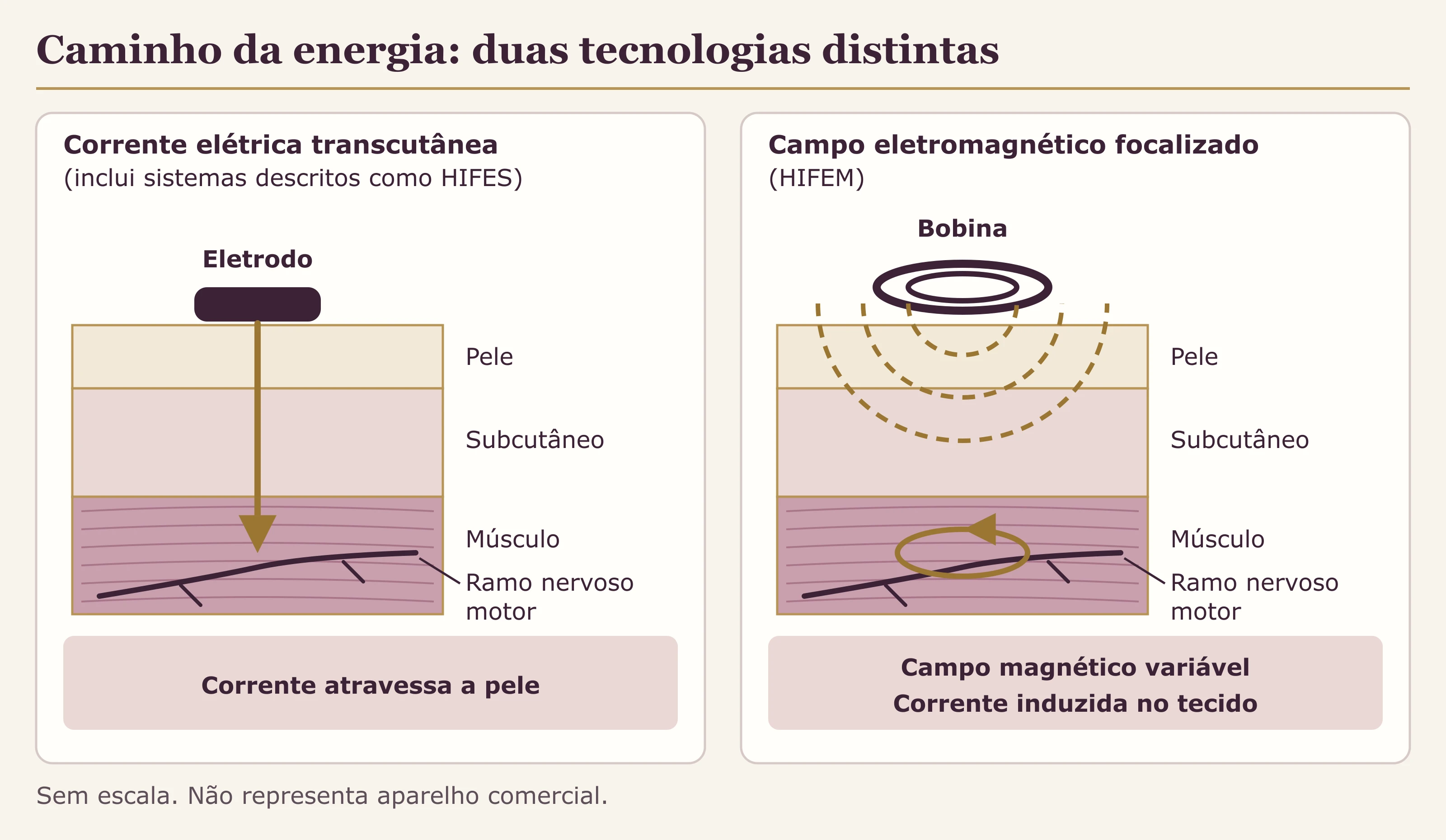 Esquema em dois painéis: à esquerda, eletrodo sobre a pele conduzindo corrente até um nervo motor; à direita, bobina gerando campo magnético que induz corrente no músculo.
