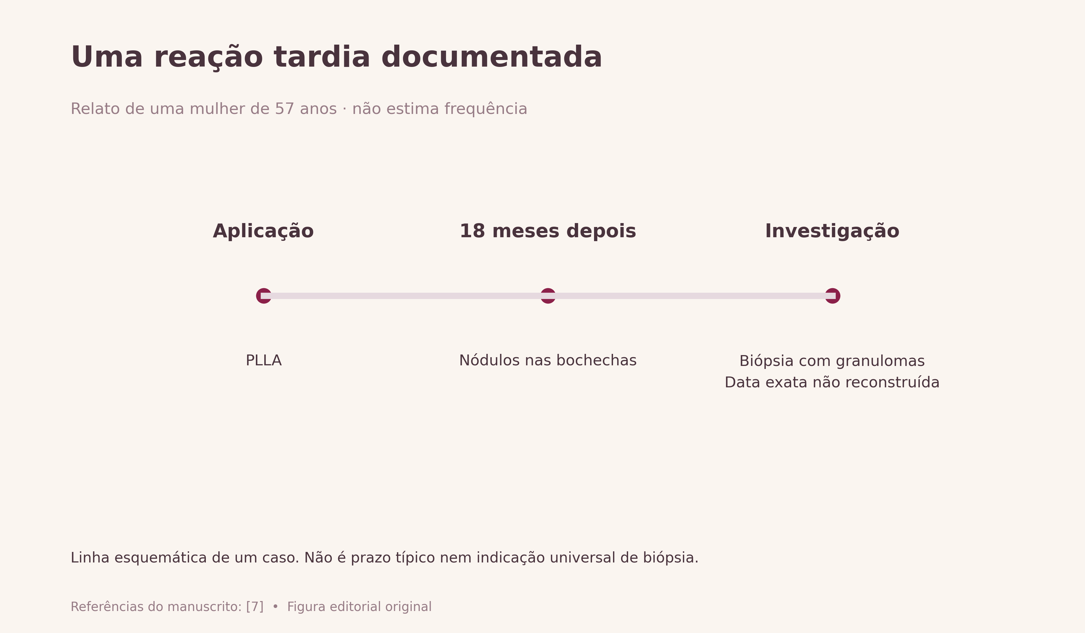 Uma reação tardia documentada. Cronologia do caso: aplicação de PLLA e nódulos nas bochechas 18 meses depois; biópsia documentou granulomas. O momento exato da biópsia não foi reconstruído, nem foi criada curva de evolução.
