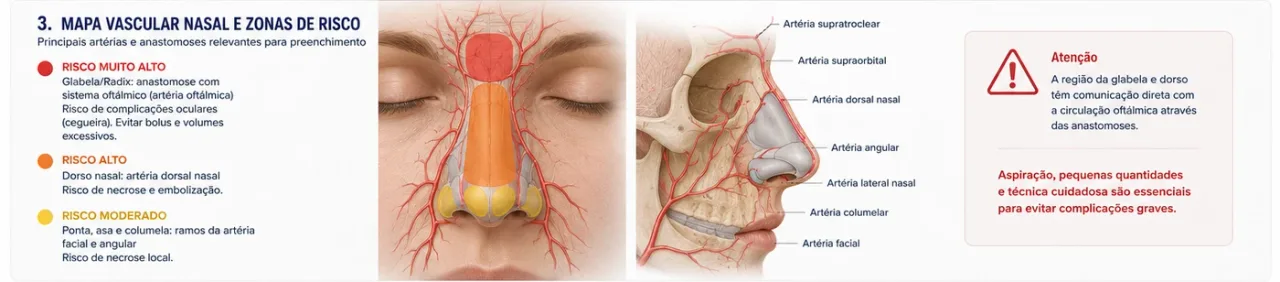 Mapa vascular nasal com zonas de risco para preenchimento